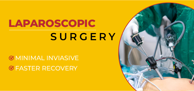 WHAT IS LAPAROSCOPIC SURGERY?